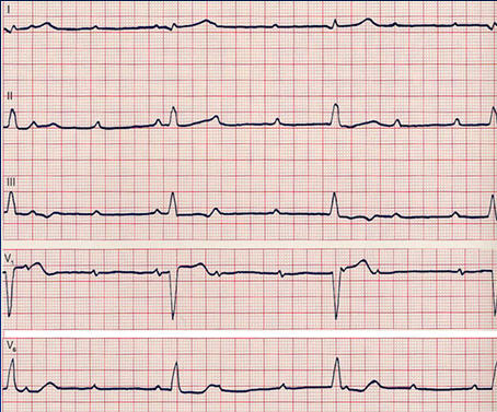 中西医结合执业医师实践技能考试心电图怎么考