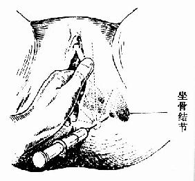 临床执业医师考试妇科学辅导:第二产程的临床