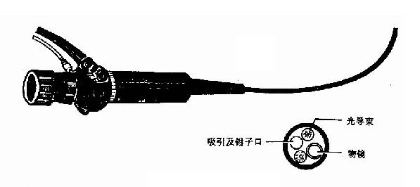 临床执业医师考试外科学辅导:纤维喉镜检查法