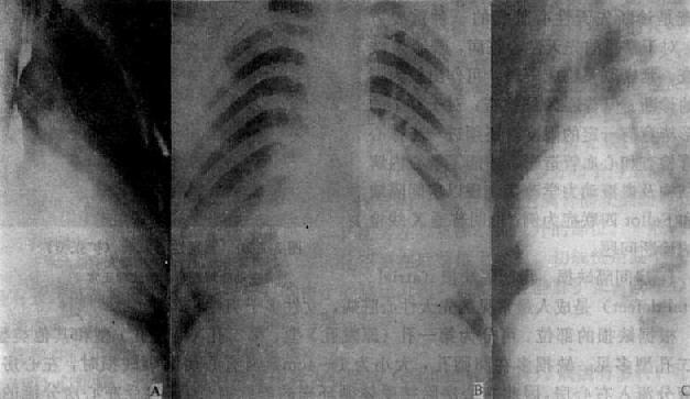 �����ȱ��