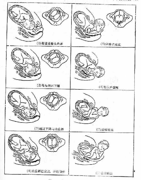 胎儿入盆示意图