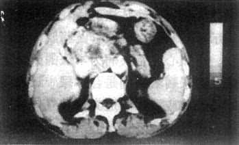 ���ٰ�CT����