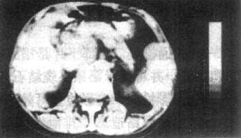 ���ٰ�CT����