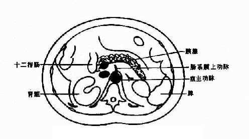 ��������CT����ʾ��ͼ