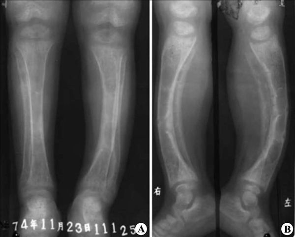 ���Ͳ�-��ͨ���䲡��Ӱ�����