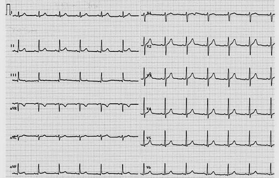 临床执业医师实践技能考试(第三站):心电图辅导5_天泽教育-职业资格考试培训领航者!