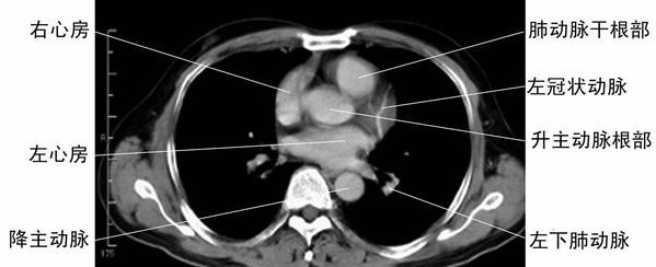 ���ķ�����-�ز�CT�ϲ�Ӱ��