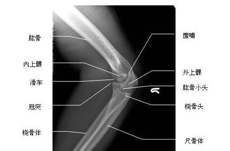 ��ؽڲ�λ-X��