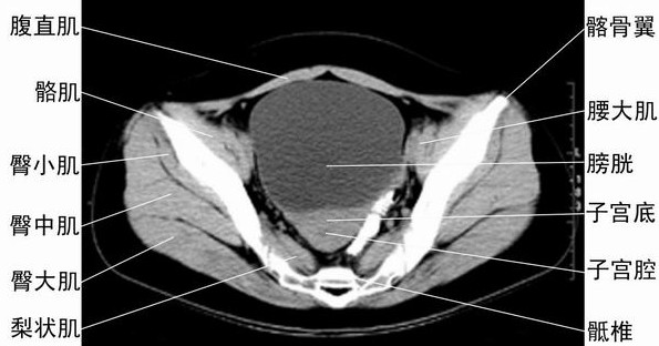 2015年实践技能医学影像学考点:女性盆腔CT断