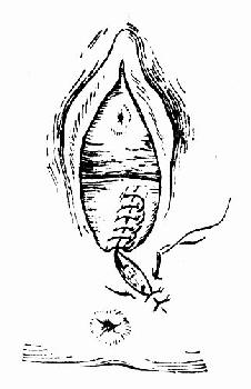 临床执业医师考试妇科学辅导:第二产程的临床