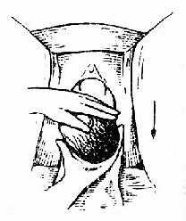 临床执业医师考试妇科学辅导:第二产程的临床