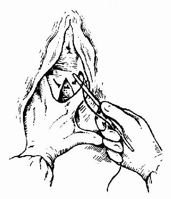 临床执业医师考试妇科学辅导:第二产程的临床