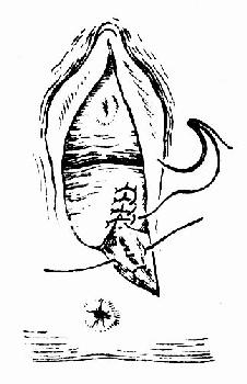 临床执业医师考试妇科学辅导:第二产程的临床