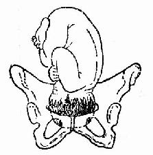 临床执业医师考试妇科学辅导:分娩机转 _ 临床